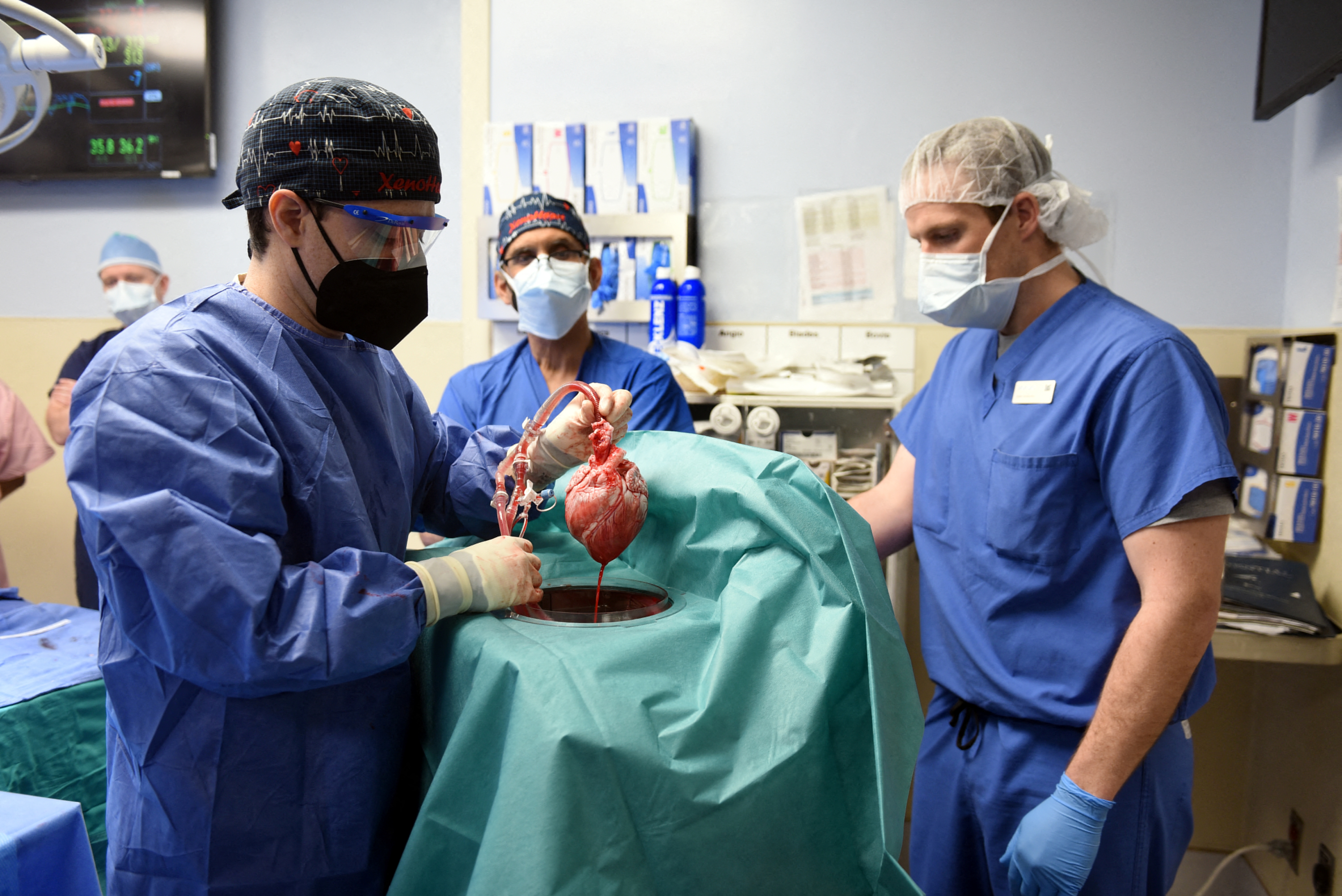 Surgeon Muhammad M. Mohiuddin, MD leads a team placing a genetically modified pig heart into a storage device at the Xenotransplant lab before its transplant on David Bennett, a 57-year-old patient with terminal heart disease, at University of Maryland Medical Center in Baltimore, Maryland, Jan. 7, 2022.