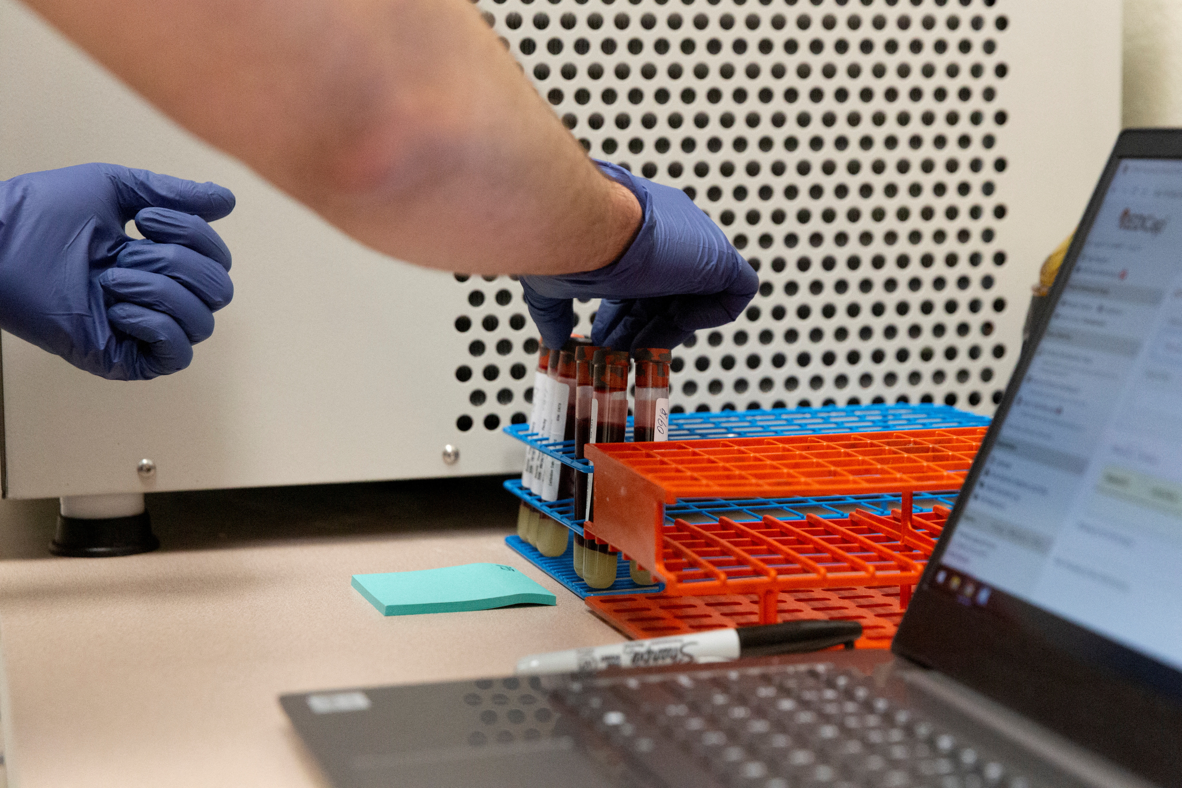 A research assistant at the University of Arizona, prepares blood samples for antibody testing for the coronavirus disease in Tucson, Arizona on July 10, 2020.