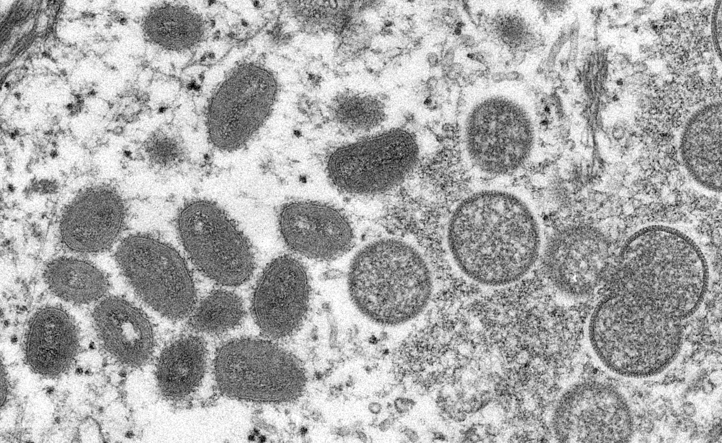 An electron microscopic image shows mature, oval-shaped monkeypox virus particles as well as crescents and spherical particles of immature virions, obtained from a clinical human skin sample associated with the 2003 prairie dog outbreak in this undated image obtained by Reuters on May 18, 2022.