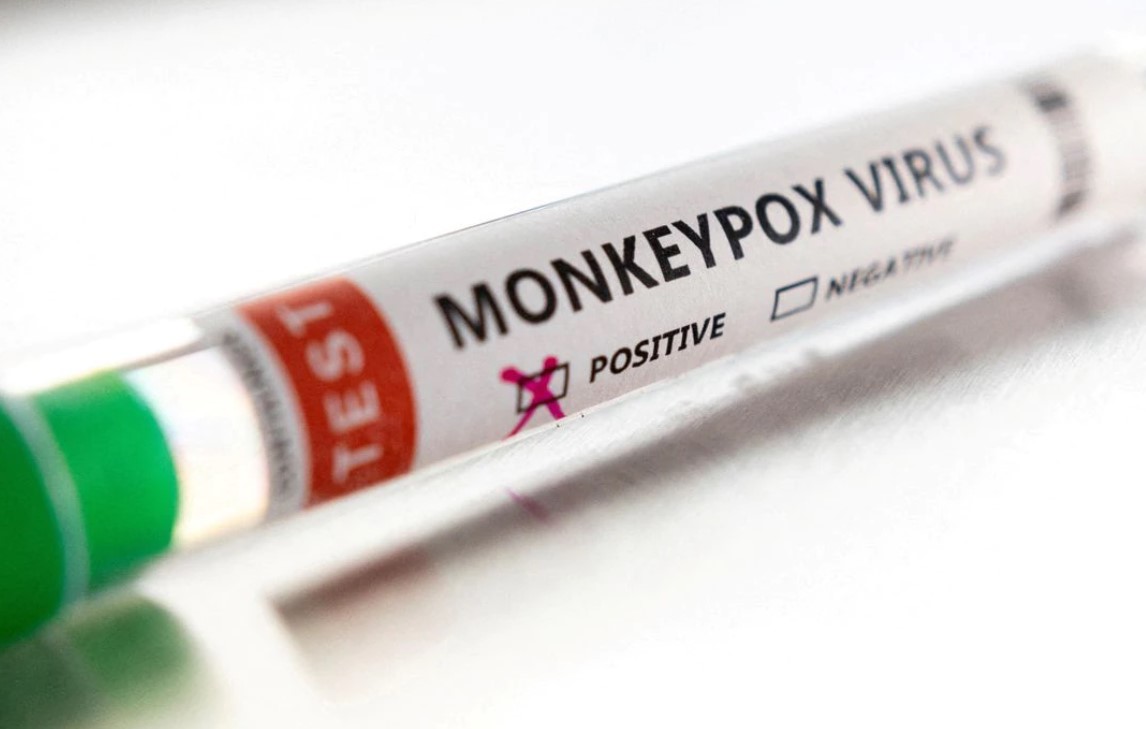 A test tube labelled "Monkeypox virus positive" is seen in this illustration taken May 22, 2022.