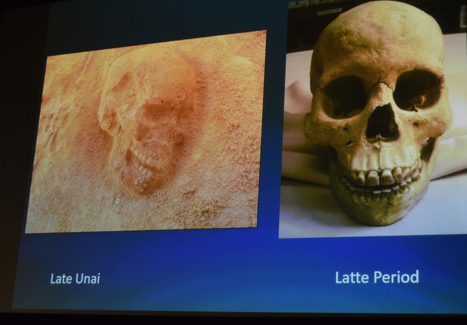These skulls of ancient Chamorros were excavated in different burial sites on Guam and Saipan.