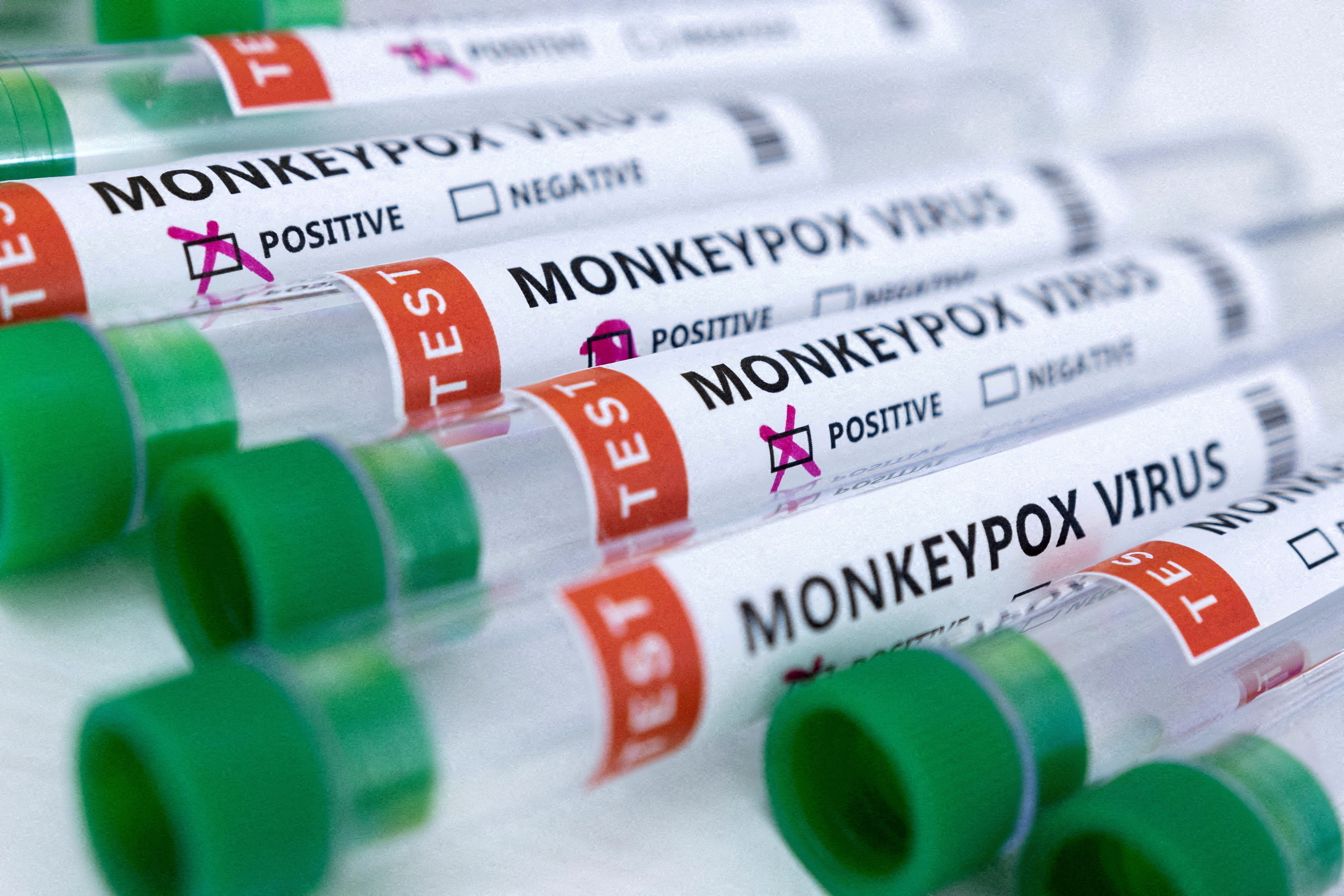 Test tubes labeled "Monkeypox virus positive and negative" are seen in this illustration taken on May 23, 2022.