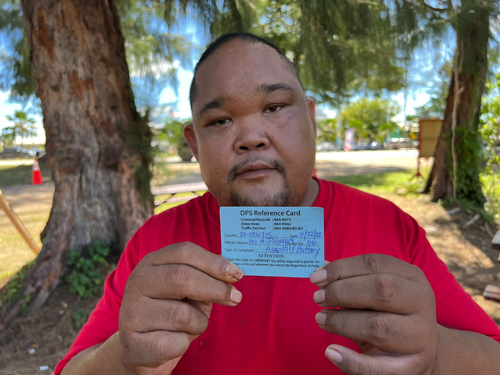 Kin Evan Taisacan says he was assaulted by an AD supporter Tuesday night.