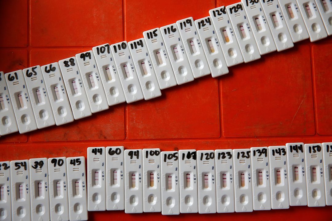 Urine samples of suspected drug addicts who voluntarily surrendered to the police are tested for different narcotic substances at a community center in Manila, the Philippines, Oct. 9, 2016.