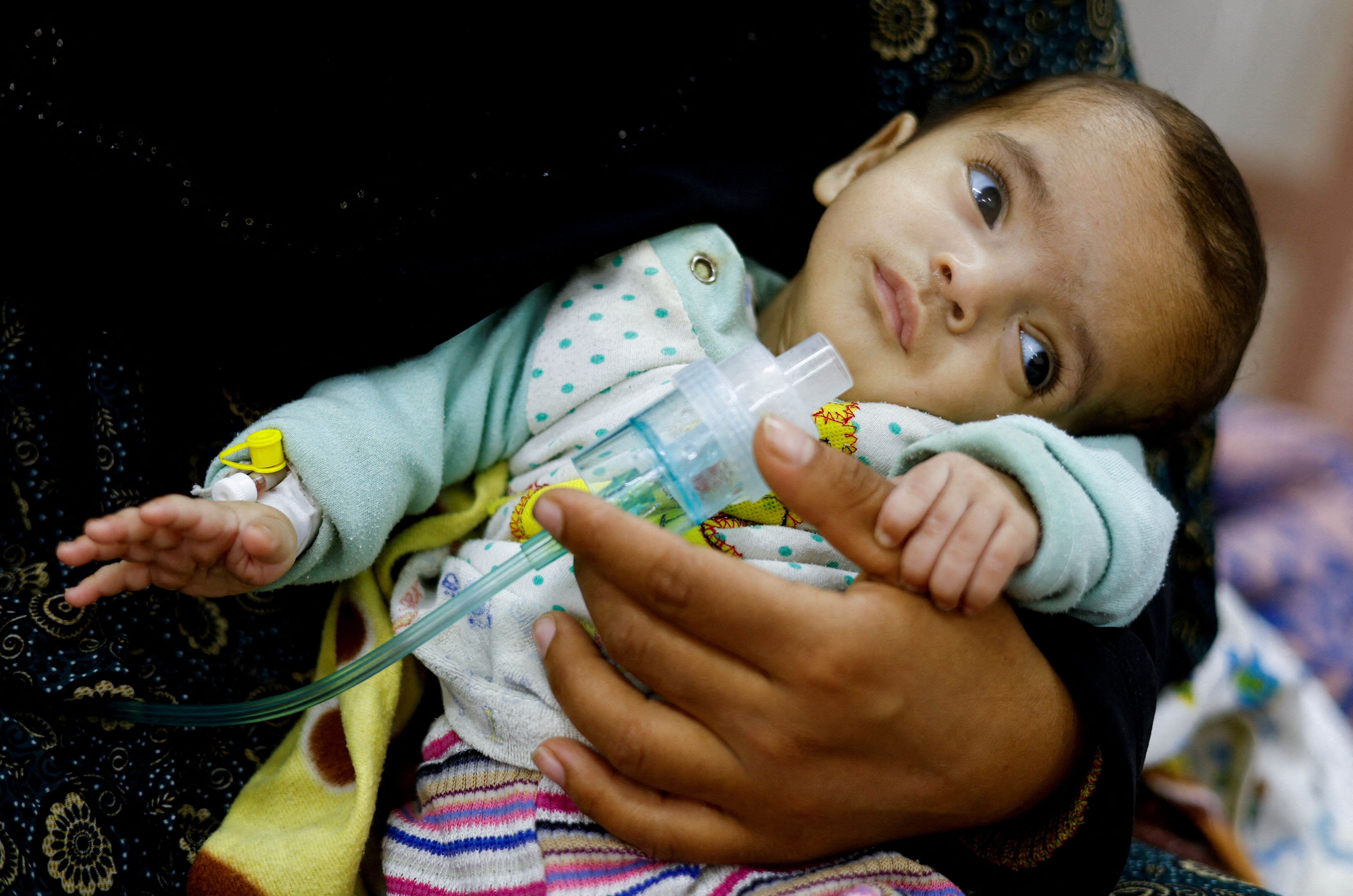 Palestinian woman Wafaa Tabasi holds her twin malnourished daughter Sameera, At al-Awda health center in Rafah in the southern Gaza Strip, March 12, 2024. 