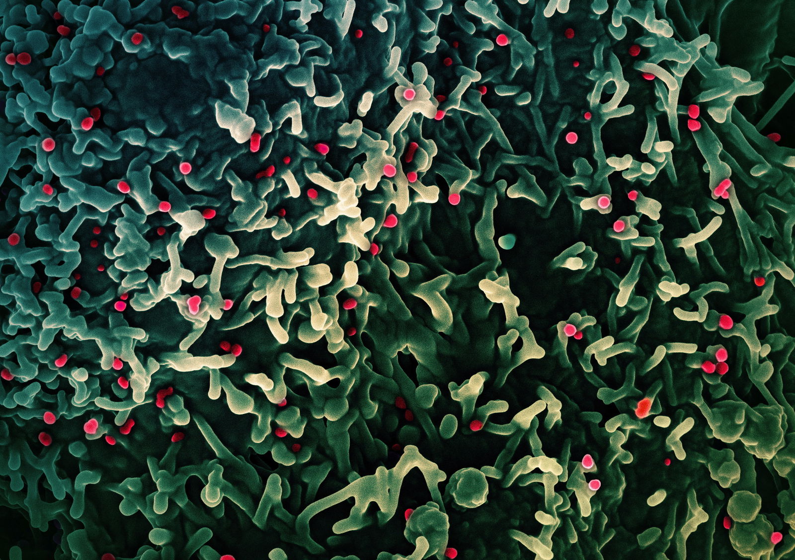 An undated colorized scanning electron micrograph of mpox virus (red) on the surface of infected VERO E6 cells (green), captured at the National Institute of Allergy and Infectious Diseases’ Integrated Research Facility in Fort Detrick, Maryland.