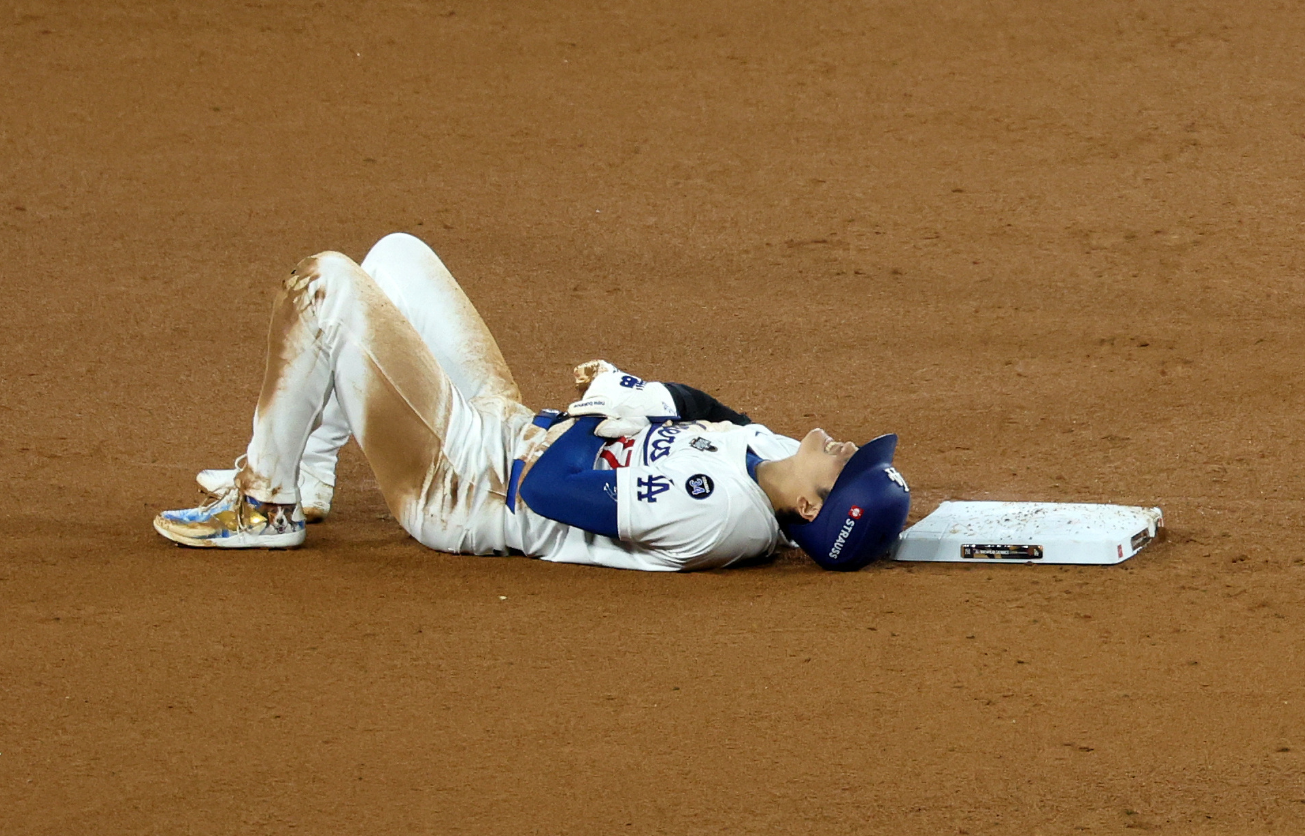 Los Angeles Dodgers designated hitter Shohei Ohtani (17) reacts after injuring his shoulder against the New York Yankees in the seventh inning for game two of the 2024 MLB World Series at Dodger Stadium in Los Angeles, California, Oct. 26, 2024.
