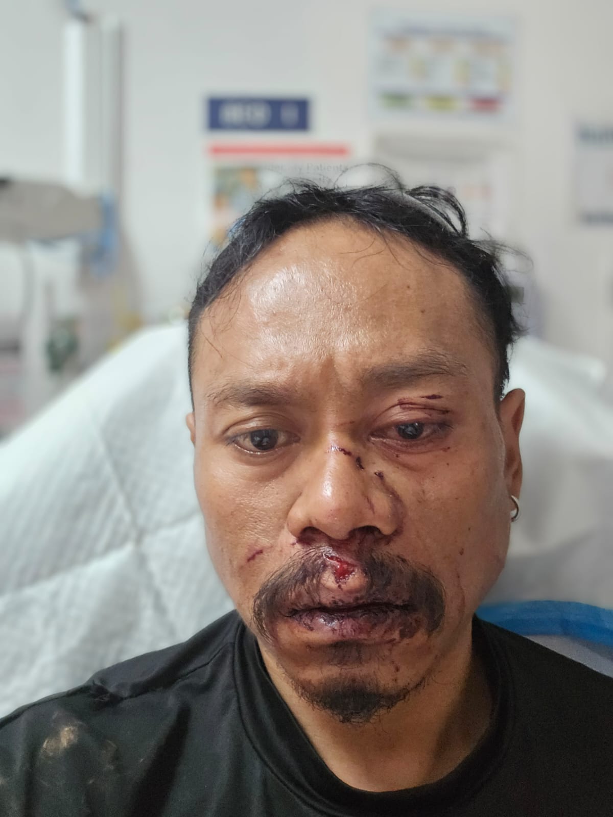 Brian Aguon, 39, was assaulted by a minor with brass knuckles.